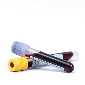 At-home Blood Testing