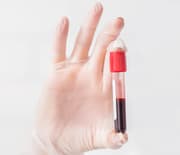 الصحة العامة