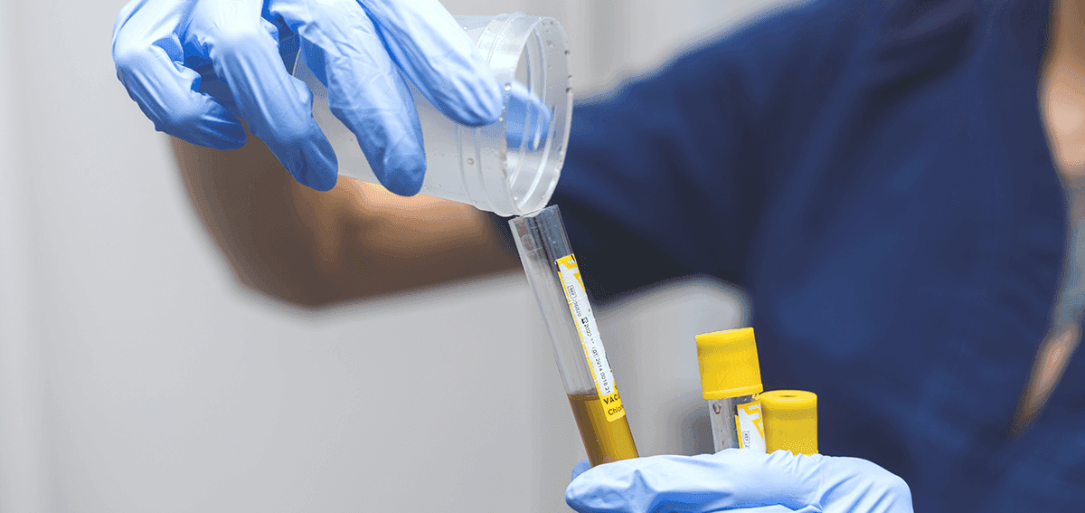 فحص شامل للأمراض المنتقلة جنسياً