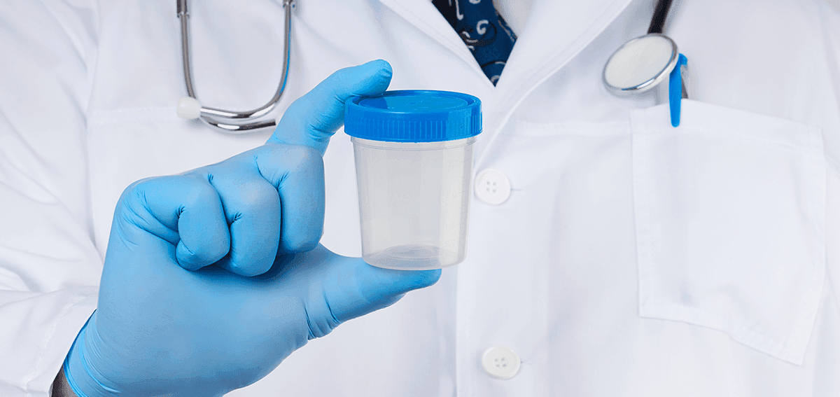 فحص الأمراض المنتقلة جنسياً